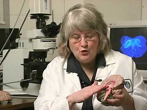 Sudden Infant Death (SIDS) Tied to Brain Chemical