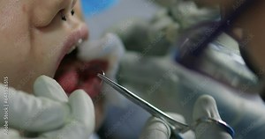 tongue splitting. cutting the tongue, one type of modification of the human body. surgery concept.