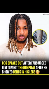 #DDG went to visit the hospital after fans were worried about the dents in his leg😳👀 | Hip Hop Ties