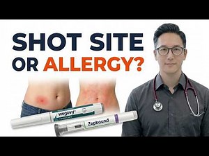 Rash or Swelling After Wegovy or Zepbound — When to Worry