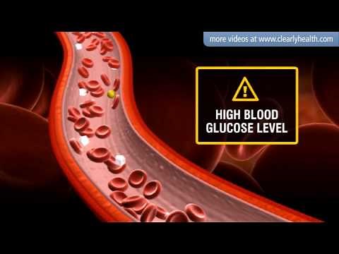 Diabetes: Insulin's side effects