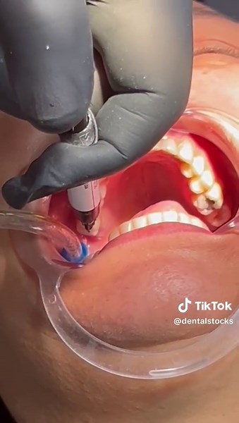 Dental Stock's on TikTok