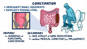 Video: Approach to constipation: Clinical sciences - Video Explanation! | Osmosis | Osmosis
