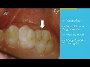 QUÁ TRÌNH MỌC RĂNG CỦA TRẺ EM
