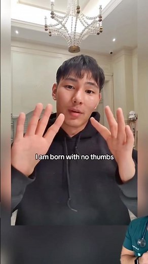 He doesn’t want thumbs?!
