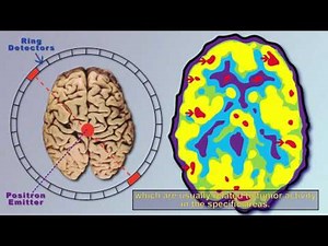 Brain Imaging