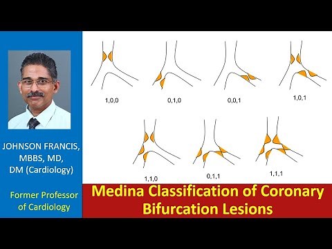 Medina Classification of Coronary Bifurcation Lesions