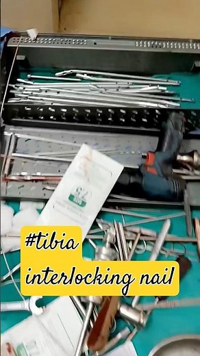 Tibia Interlocking Nail Trolley: A Complete Guide