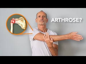 Arthrose à l'Épaule ? Le guide complet pour tous !