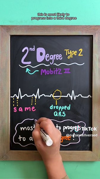 🫀 TYPES OF HEART BLOCKS A heart block is a type of arrhythmia due to electrical impulses that control the heart being disrupted. There are 4 main heart blocks you need to know: 🔴 1st Degree Heart Block → Slow conduction through AV node → EKG shows prolonged PR interval ⭐️Rhyme to Remember: “If the R is far from P, then you have a first degree.” 🔵 2nd Degree Type 1 (Wenckebach) → PR intervals gradually get longer until a QRS complex drops completely ⭐️Rhyme to Remember: “Longer, longer, longer