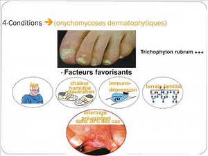 PARAZITOLOGIE dermatophytes et dermatophyties