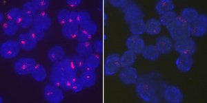 Sex Chromosomes to Blame for Women's Risk of Autoimmune Diseases | Immunology