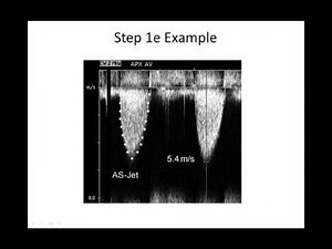Intro to Aortic Stenosis