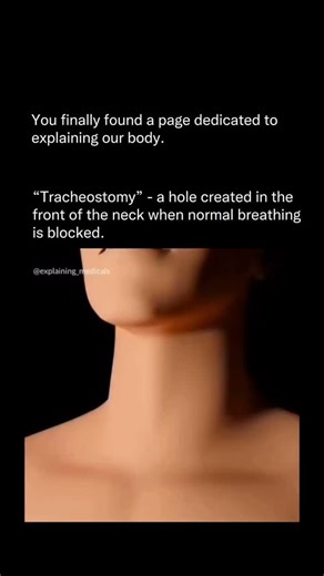 Explainingourbody | A tracheostomy is one of the most life-saving procedures in medicine — but most people only know it as “a hole in the neck.” In reality,... | Instagram