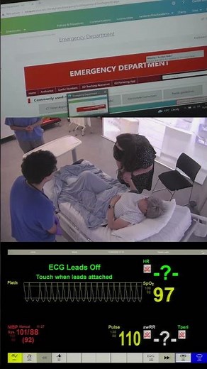 Acute Kidney Injury (AKI) Simulation