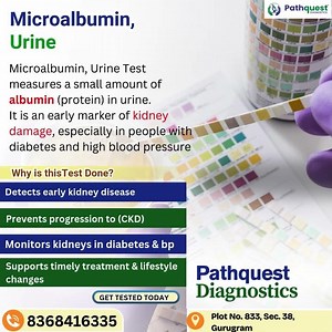 Microalbumin Urine Test | Early Kidney Damage Detection | Pathquest Diagnostics #urinetest