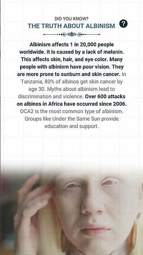 The Truth About Albinism | Factopedia | #fact #facts #shorts