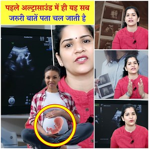 The First Scan of Pregnancy Gives All These Essestial Information - Did Someone Tell You This | Pregnancy Tips and Information