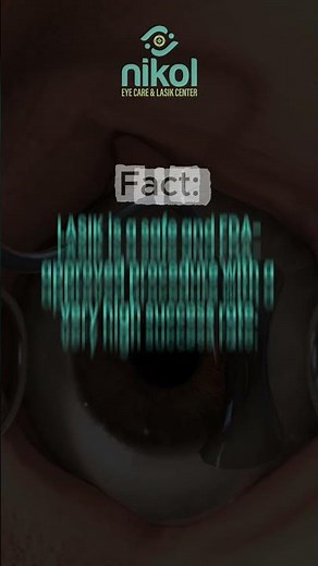 LASIK Surgery Myths vs Facts 👁️ | Is LASIK Safe & Painful? Explained!