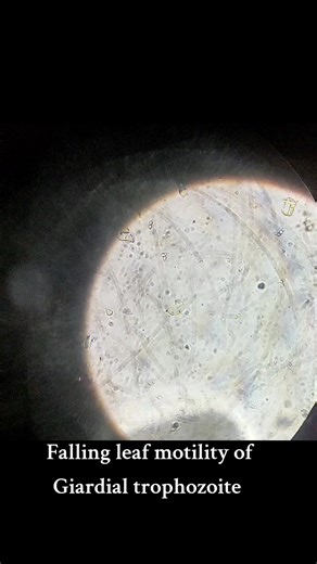 Falling Leaf Motility of Giardial Trophozoite