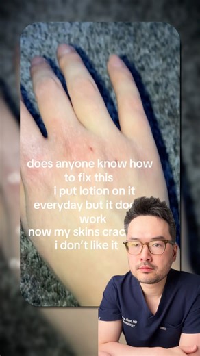 Dry hand routine from someone who cleanses his hands 50+ times per day 🙌#dermatologist #skincare