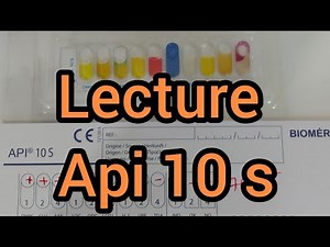 lecture de la galerie biochimique api 10s