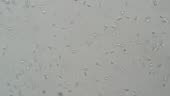 Human sperm under microscope 400x video