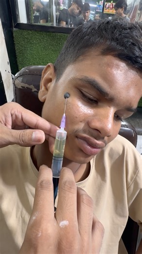 पुराने से पुराने Pimples का Face Spa Treatment 😱🔥 | Amazing Facial Result | salon#reels#shorts#vi