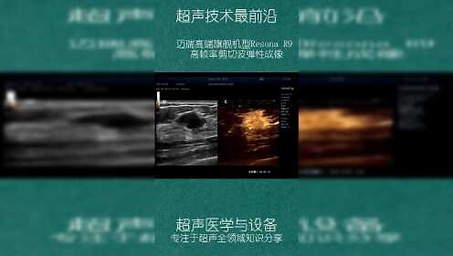 迈瑞ResonaR9高帧率剪切波弹性成像