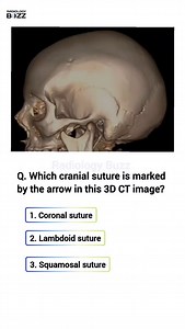 74 reactions · 31 shares | 易 Anatomy Quiz: Cranial Sutures!樂 This 3D...