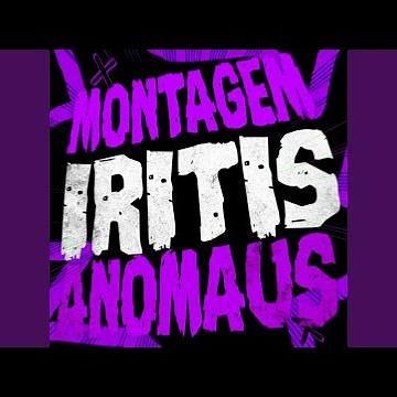 MONTAGEM IRITIS ANOMAUS