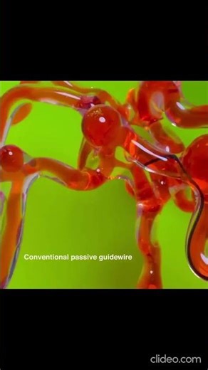 MIT Magnetic Robot Thread 😱 | Future of Stroke Treatment Explained