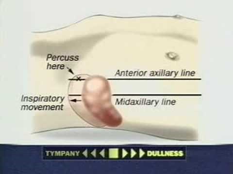 Examination of the Spleen
