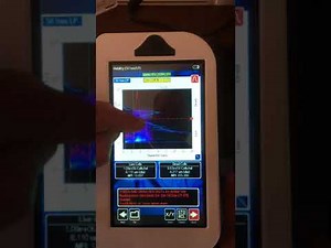 PBMC Cell Count and Viability Test