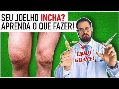 Água no Joelho: As Principais CAUSAS e TRATAMENTOS para o Derrame Articular [Aula Completa]