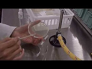 SAFE USE OF ANTIMICROBIALS: NOVOBIOCIN TEST PART 1