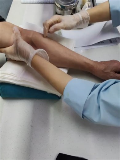 China's Lightning-Fast Medical Skills: Flying Needle Technique