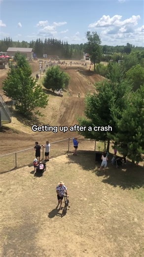 Broken Femur Recovery: My Journey to Come Back Stronger