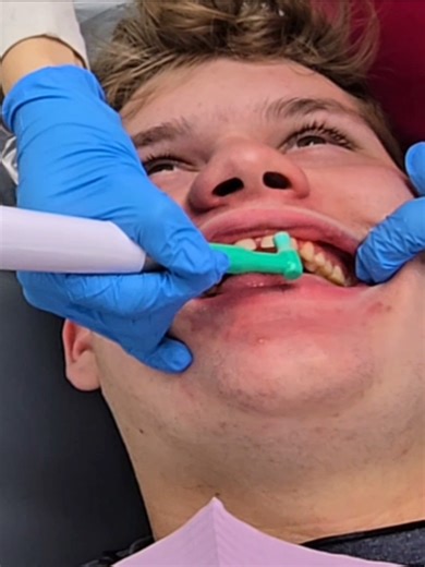 Getting his teeth cleaned. Tickle, tickle, tickle! #Dentist #AutismAwareness #AutismAwareness #Autism #Inclusion