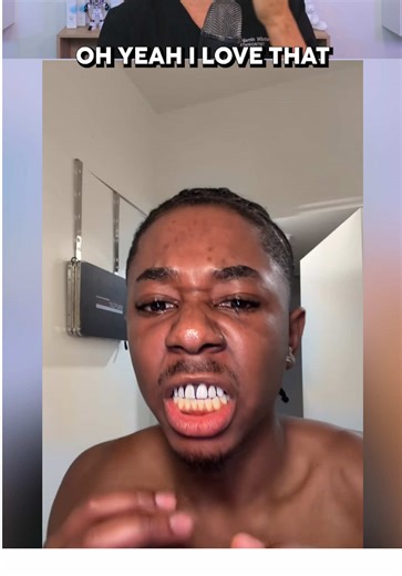 Exposing Another Teeth Whitening SCAM! 😬🦷 | Hydrogen Peroxide