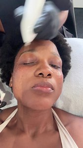 Skin Treatment Transformation: Before and After Results