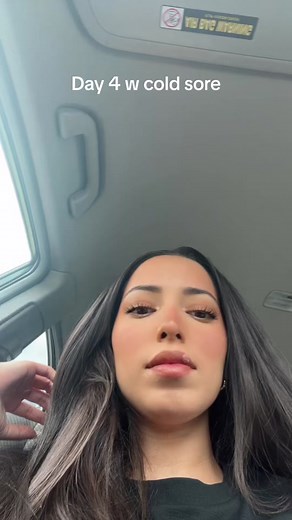 Covering Cold Sore on Face with Makeup