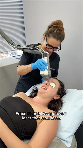 This helps with pigmentation - Fraxel Laser ✨ #dermatologyclinic