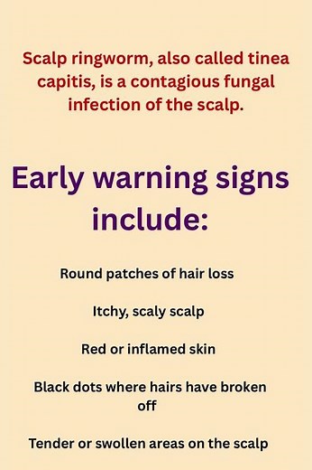 Scalp Ringworm – Early Warning Signs.