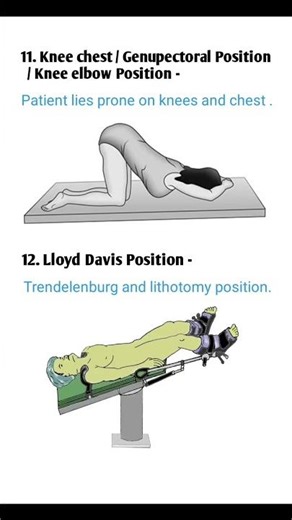types of positions