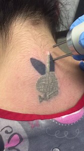 199K views · 1.5K reactions | Doing our thing. This is the first treatment of a multiple treatment process. What you are seeing is a gas that is released from the ink when it is shattered by the laser. There is no burning or scarring occurring. cleancanvaslaser.com. Consultations and test spots are always free. By appointment only. | Clean Canvas Laser Tattoo Removal | Facebook