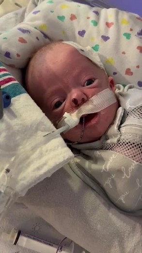 NICU Baby With Choanal Atresia | Surgery, Stents & Survival #nicujourney #newbornbaby