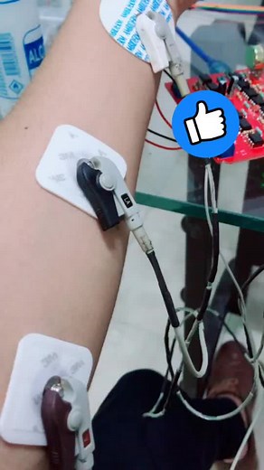 Sensor muscular Arduino #arduino #arduinoproject #arduino_project #robotics