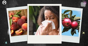 10 frutas que te pueden causar alergia… y no lo imaginabas