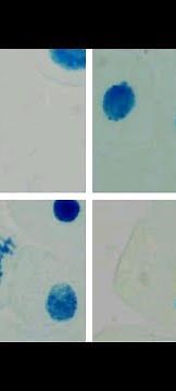 Methylene blue stained onion root tip cell division stages